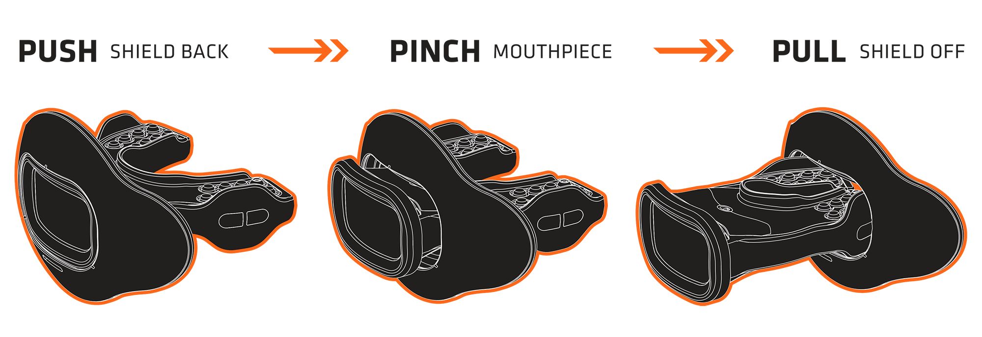 Interchangeable Mouthguard